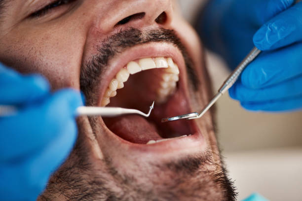 Best Emergency Treatment for Dental Infections or Abscesses in Hines, OR